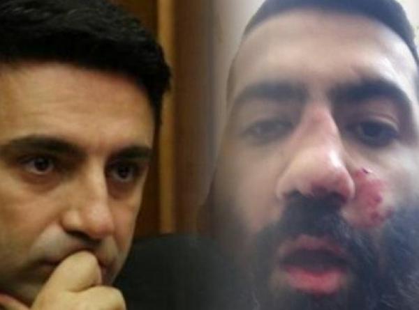 Вице-спикер парламента Армении ударил головой в нос журналисту
